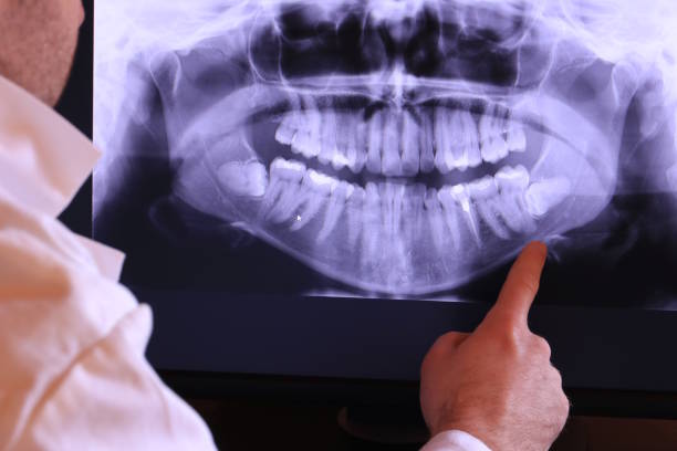 Best Weekend Emergency Dentist in Santa Venetia, CA