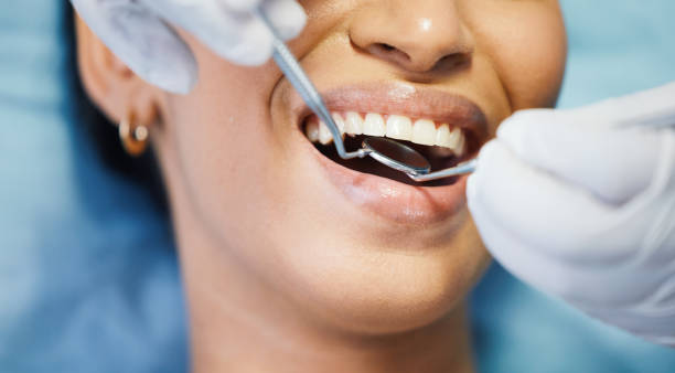 Best Emergency Broken Tooth Repair in Santa Venetia, CA