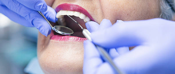 Best Weekend Emergency Dentist in Santa Venetia, CA
